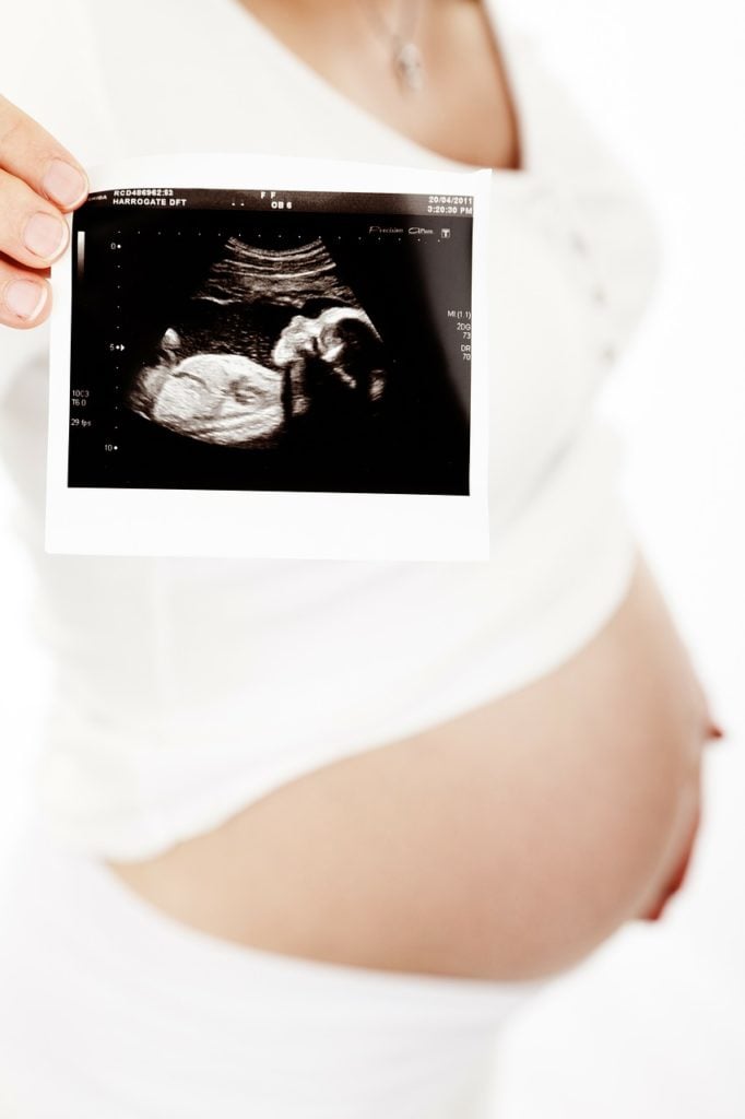 An ultrasound image from a visit at the doctor's office.